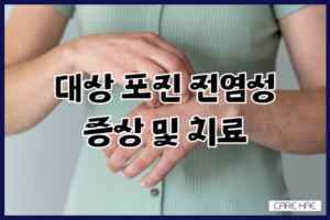 대상포진 전염성 초기증상 치료 및 면역력 높이기