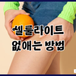 셀룰라이트 없애는 방법 허벅지 지방 없애기 다리관리